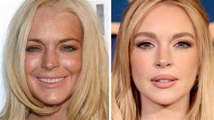 What Did Rebecca Romijn Do To her Face? Plastic Surgery Before And After, Net Worth