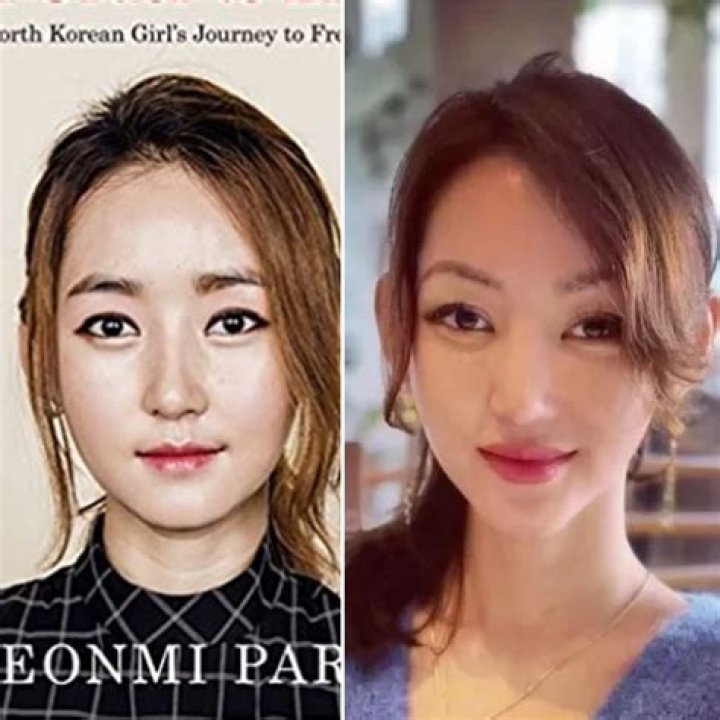 Yeonmi Park Plastic Surgery Before After Pics, Age And Husband Revealed